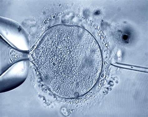 In Vitro Fertilisation Light Micrograph Stock Image C040 3058