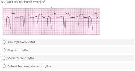 Ventricular Paced Rhythm