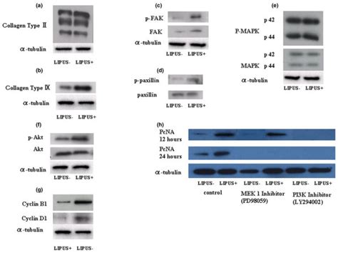 Western Blotting Analysis A Type Ii Collagen B Type Ix Collagen Download Scientific