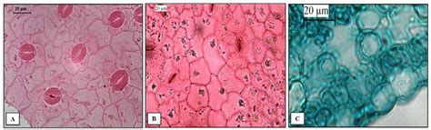 Lower epidermis showing; A-Anomocytic stomata in surface preparation (x ...