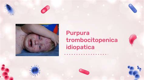 Purpura Trombocitop Nica Idiop Tica Health Classes Udocz