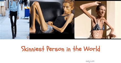 Top 7 Skinniest Persons in The World (2025 Report) — Awajis