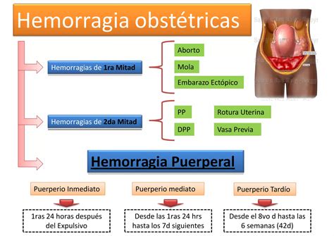 Hemorragia Postparto Ppt