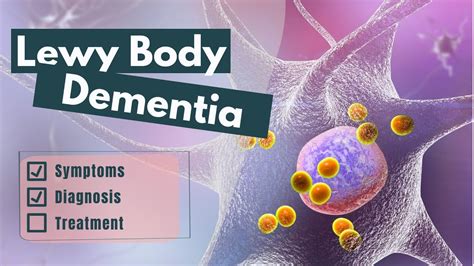 Lewy Body Dementia Diagnosis And Treatment