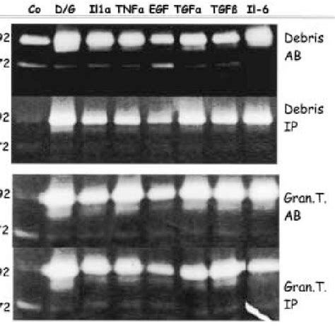 Zymographic Analysis Of Cell Culture Medium Of Stimulated Eacs