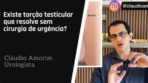 Recuperação Rápida Tempo De Recuperação Da Torção Testicular Actualizado Outubro 2024