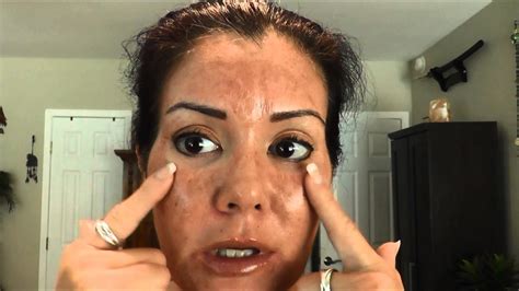 Perfect Derma Peel Day Youtube