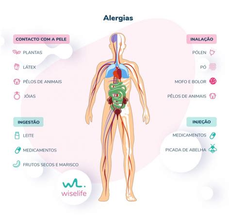 O que são as alergias Wiselife
