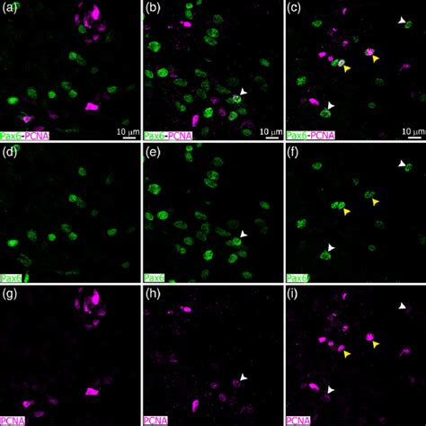 Pax6 Cells Appear To Be Mostly Negative For The Mitotic Cell Marker