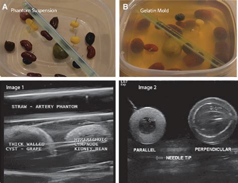 Figure 1 From A Method Using Superconcentrated Gelatin And A Novel