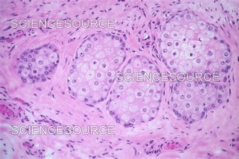 Photograph Sebaceous Glands Of A Monkey Lm Science Source Images