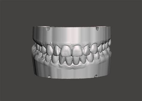 Fichier Stl Mod Les D Tude Dentaire Mod Le Pour Impression D