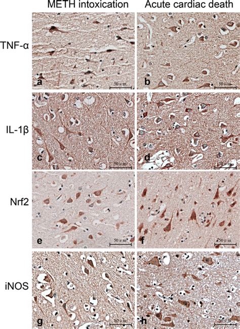 Immunostaining Of Tnf α A And B And Il 1β C And D Nrf2 E And F