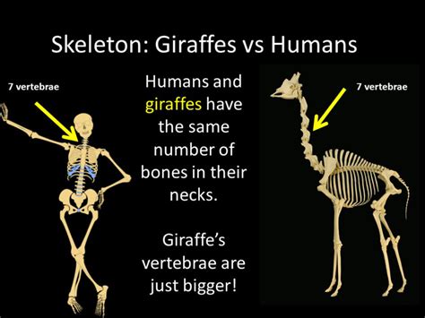 I Wish I Had As Many Neck Bones As A Giraffe… - Rocky Mountain Brain ...