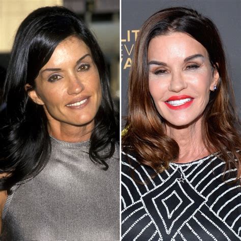 Celebrity Facelifts and Plastic Surgery: See Then-and-Now Pics | Life ...