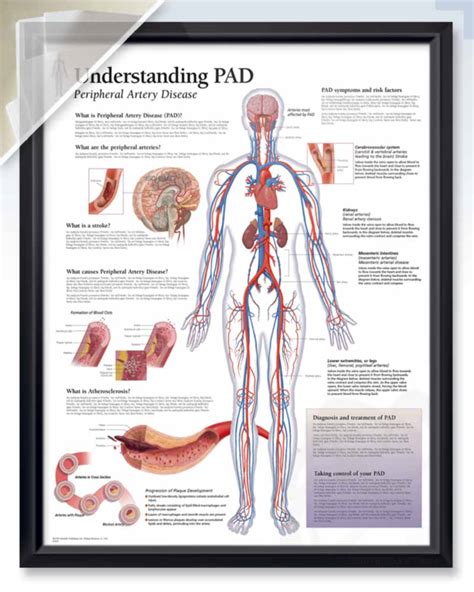 Understanding Pad Exam Room Anatomy Poster