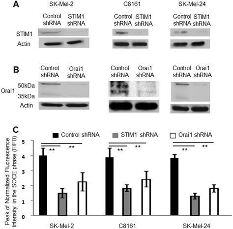 Soce Was Inhibited By Stim Or By Orai Knockdown In Melanoma Cell