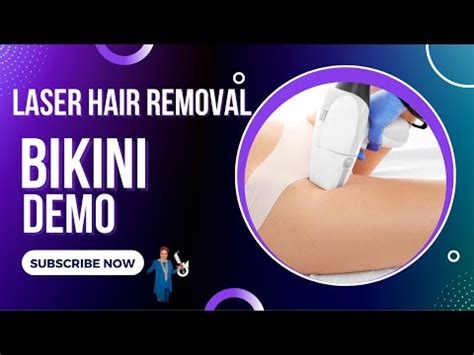 Bikini Laser Hair Removal Demo Miami Fl And South Atlanta GA YouTube