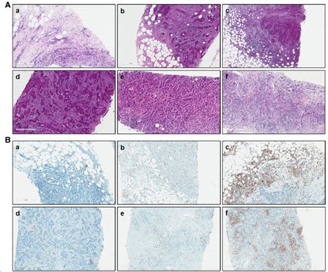 Representative Hande And Immunohistochemistry Ihc Staining Images Show