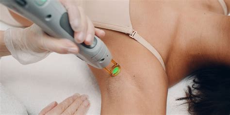 How Many Sessions Of Laser Hair Removal For Armpits Under Tec