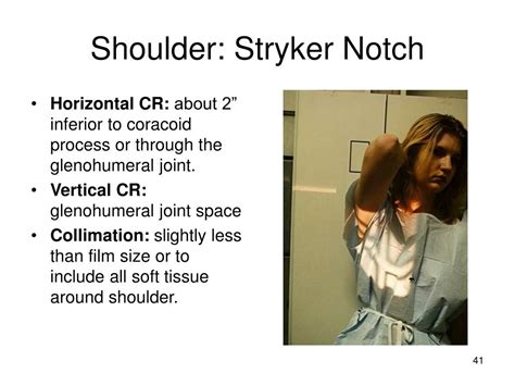 Ppt 141 Shoulder Radiography Powerpoint Presentation Free Download