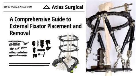 A Comprehensive Guide to External Fixator Placement and Removal