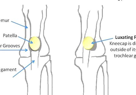 Luxating Patella Dog Dislocated Knee