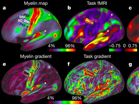 This Mind Blowing Brain Map Accomplishes Something That Scientists Have