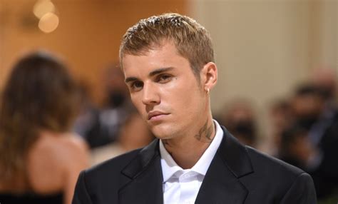 What Is Ramsay Hunt Syndrome Condition That Has Caused Justin Biebers