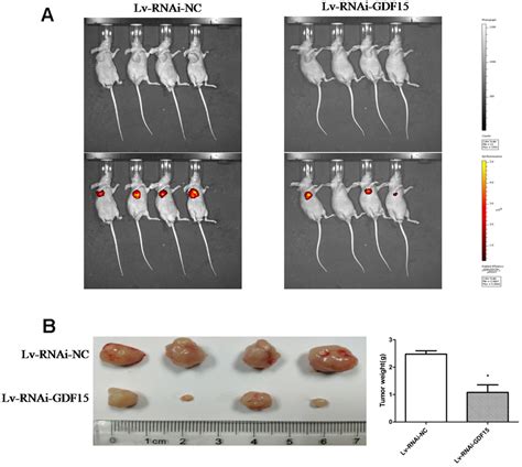 Upregulated Gdf Expression Facilitates Pancreatic Ductal