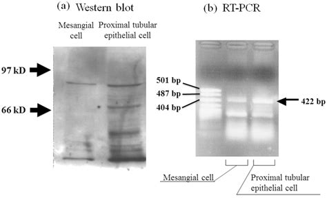 Western Blot A And Rt Pcr B Of Sodium Glucose Cotransporter The