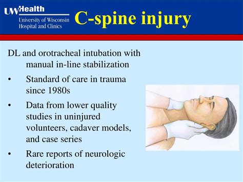 Ppt Airway Management In Trauma Trauma Conference Uw Hospital And