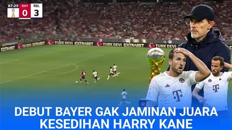 Baru Aja Sampai Sudah Disuruh Debut Harry Kane Dan Kesedihannya Kembali