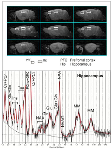 Voxels Localised On PFC And Hip Are Indicated By The White Rectangles