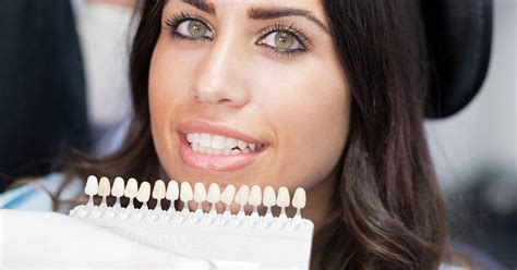 Your Guide To Dental Veneers Everything You Need To Know