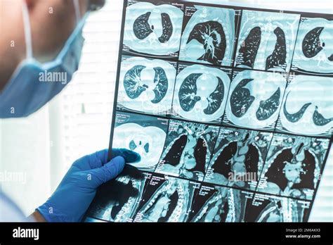 Doctor examining MRI image in hospital Stock Photo - Alamy