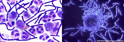 4 5 Deeply Branching Bacteria Microbiology Openstax