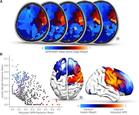 Fluid Intelligence Mapped To Right Frontal Brain Regions