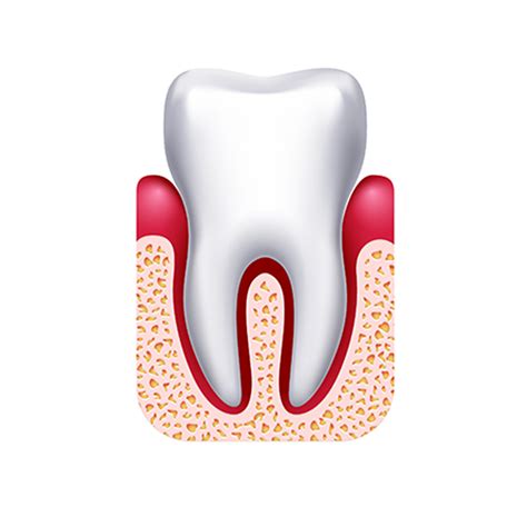 Walnut Hill Dental Group Gum Pain Or Gingivitis In Pasadena Walnut