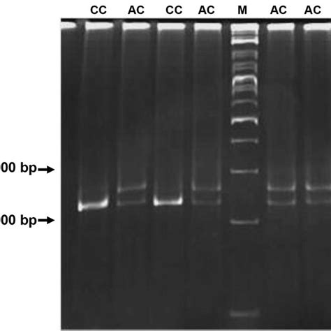 A Mismatch Pcr Rflp Technique Used For Genotyping Of Rs7270101 In Itpa