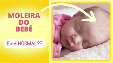 Topo Imagem O Que Significa Quando A Moleira Do Bebe Esta Funda