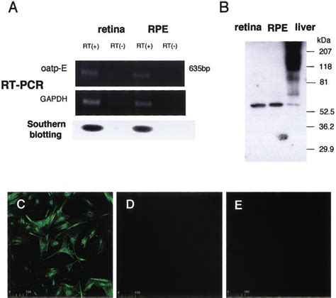 Oatp E Expression In Rpe Cells A Rt Pcr And Southern Blot Analysis