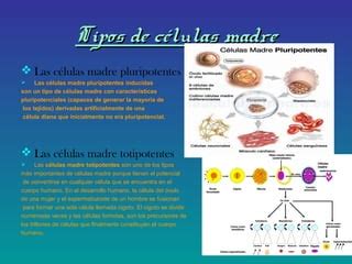 Células madre PPT