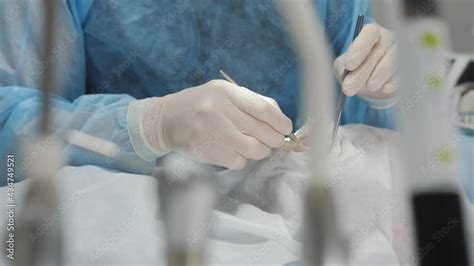 The Dentist Surgeon Prepares For The Implantation Of A Dental Implant