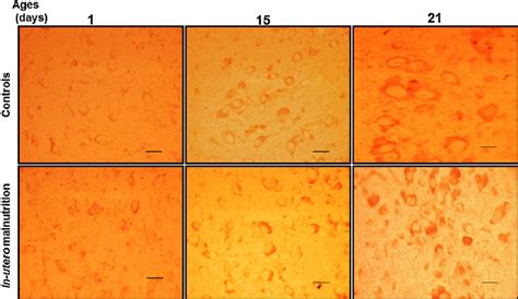 Photomicrographs of longitudinal cuts at the level of the dorsal raphe ...