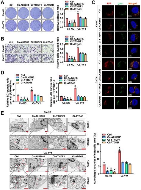 YY1 Is Regulated By ALKBH5 Mediated M6A Modification And Promotes