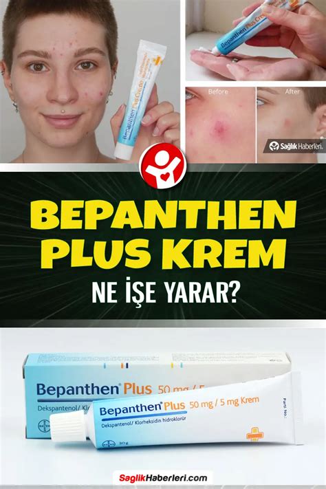 Bepanthen Plus krem ne işe yarar sivilceye iyi gelir mi Sağlık