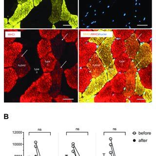 fibre type distribution  fibre cross sectional areas  myofibers