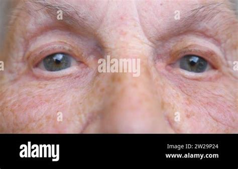 Old Woman Watching Into Camera With Wide Eyes Close Up Of Wrinkled Female Face Showing Surprise