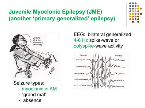 Juvenile Myoclonic Epilepsy